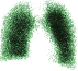 varredura do pulmo com criptnio-81m